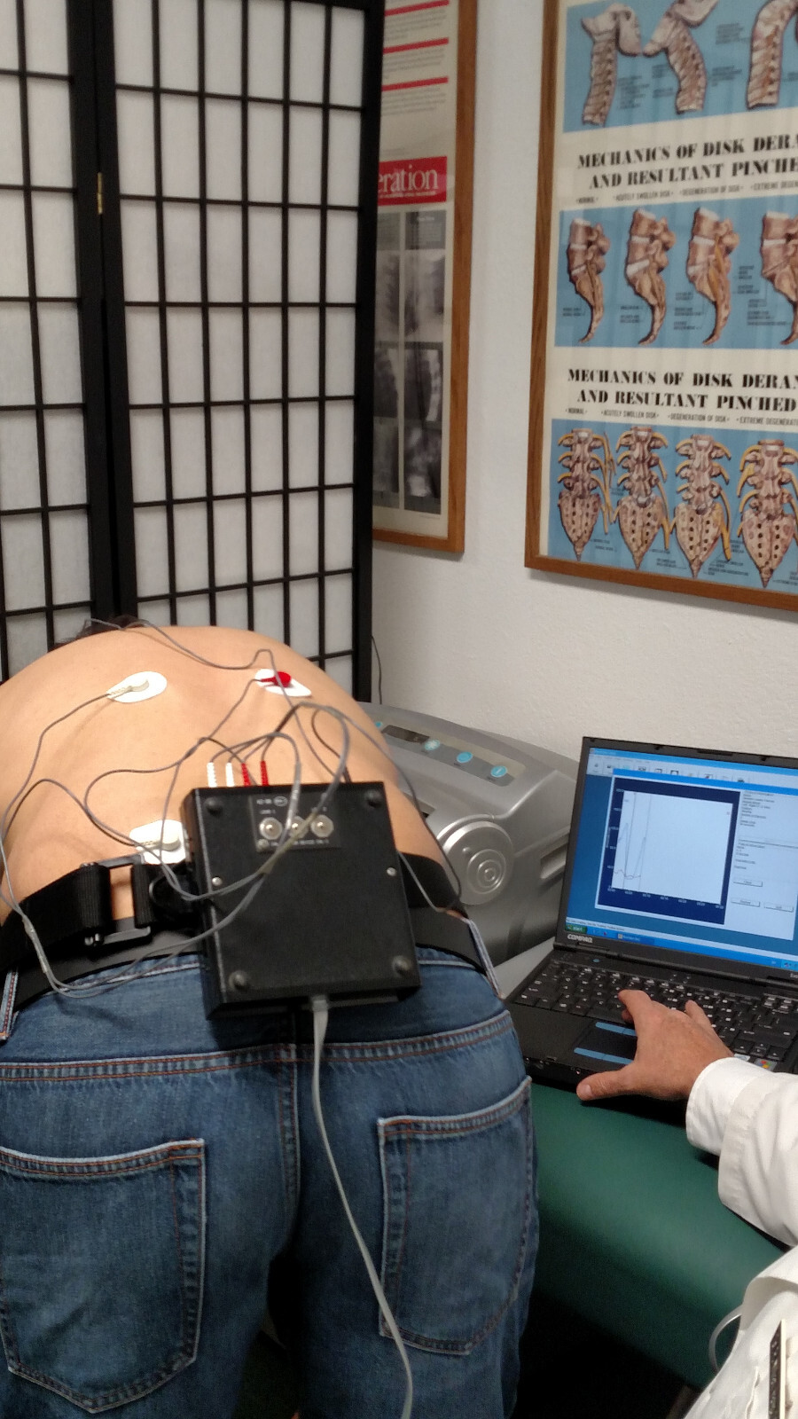 Myovision 8000 Dynamic sEMG wValidated Laptop Chiropractic Chiropractor WrksGr8!