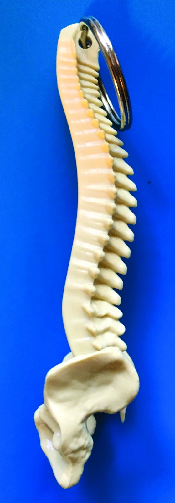 1000 PERSONALIZED SPINE KEY TAGS – KEY CHAIN – BAG OF BONES – CHIROPRACTIC