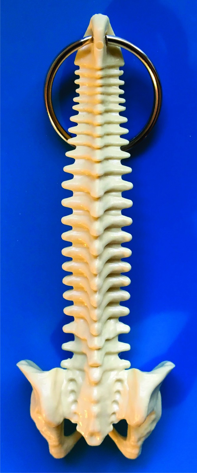 1000 PERSONALIZED SPINE KEY TAGS – KEY CHAIN – BAG OF BONES – CHIROPRACTIC