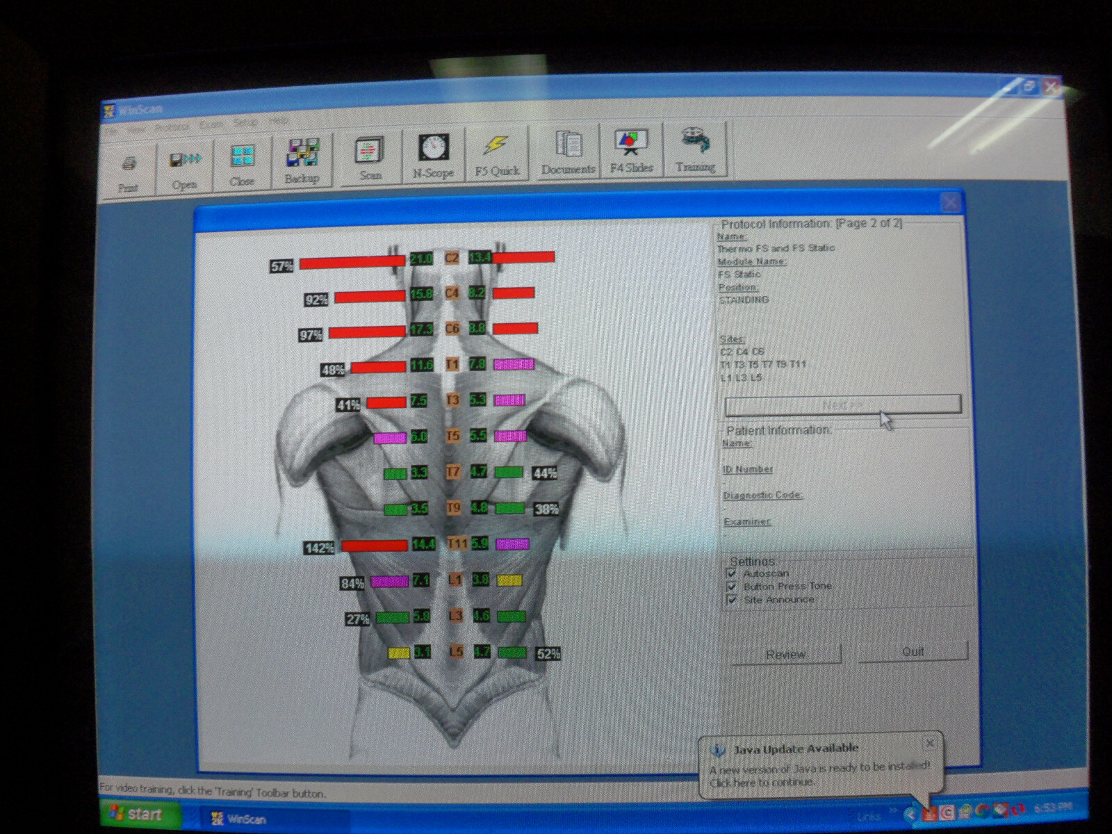Myovision 8000 Static sEMG with Validated Laptop Chiropractic Chiropractor