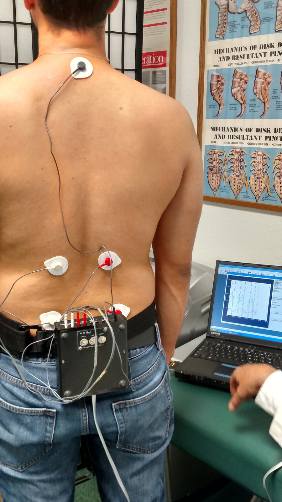 Myovision 8000 Dynamic sEMG wValidated Laptop Chiropractic Chiropractor WrksGr8!