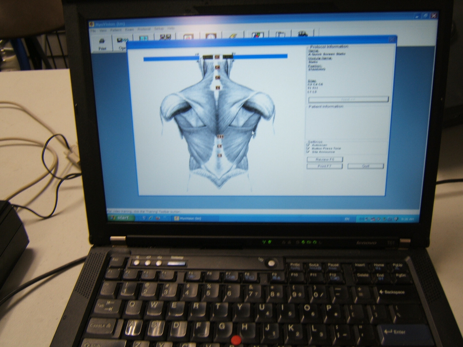 Myovision 8000 Static sEMG with Validated Laptop Chiropractic Chiropractor