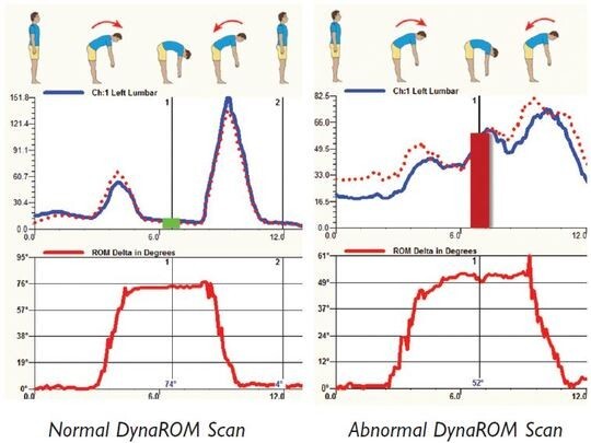 MyoVision DynaROM Motion EMG – Recertified New